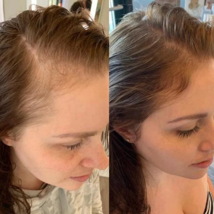 NeoPulse - Hair Growth System