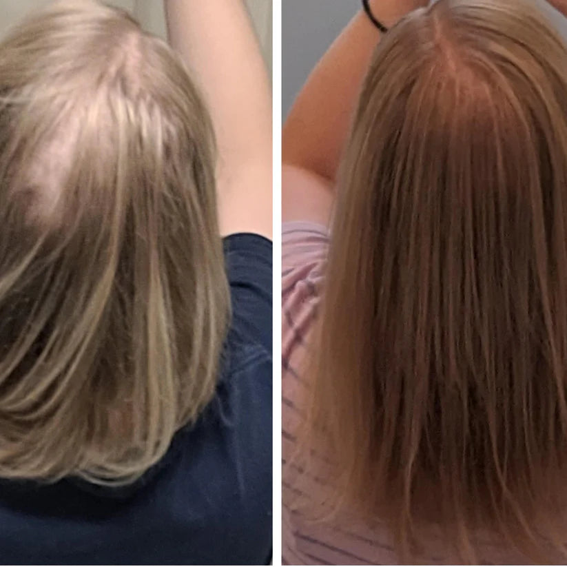 NeoPulse - Hair Growth System