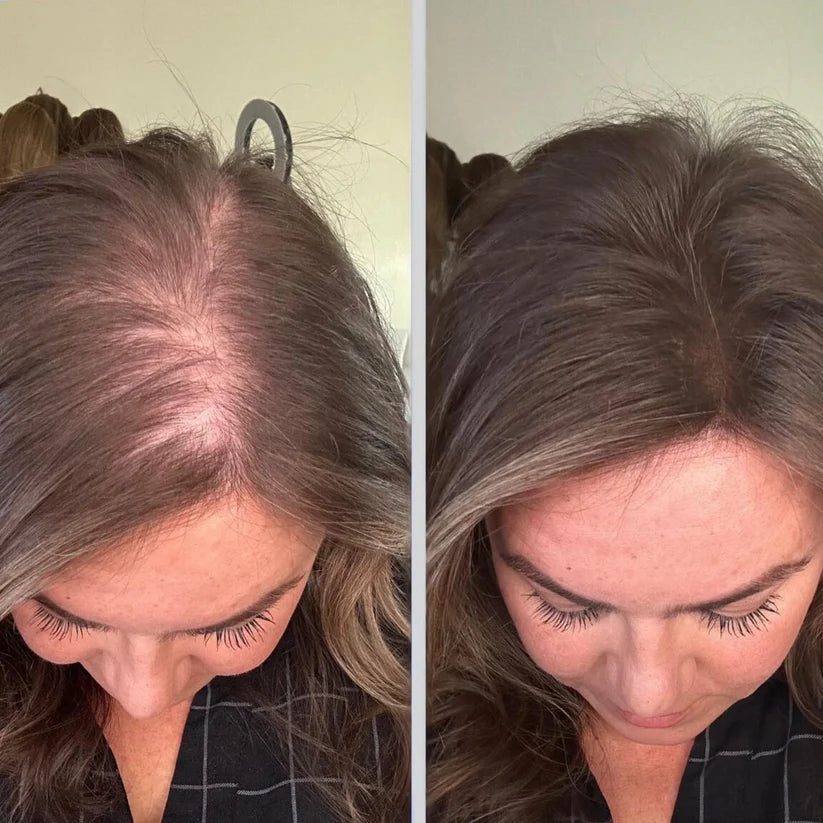 NeoPulse - Hair Growth System