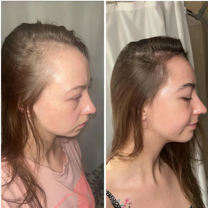 NeoPulse - Hair Growth System