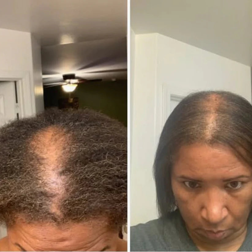 NeoPulse - Hair Growth System